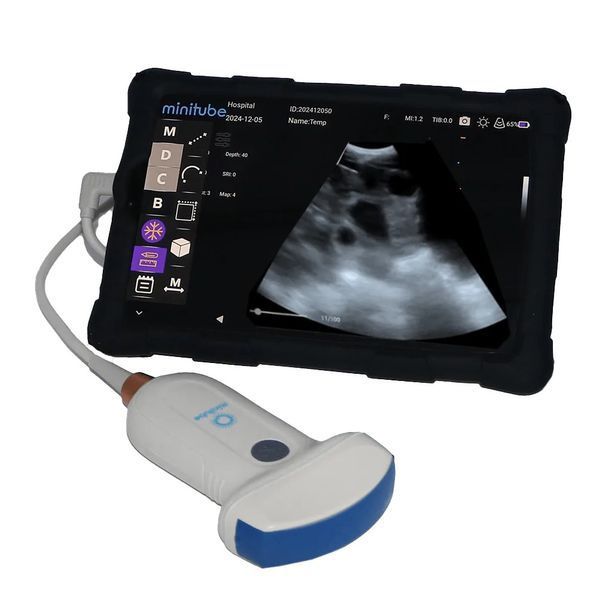 Ультразвуковий сканер Minitube 3.0 Plus 23500/2005 фото